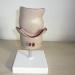 Hemorrhoid Model Model of Human Rectal Disease Hemorrhoids Internal and External Hemorrhoids Pathological Model Communication - Buy Online on GoSupps.com