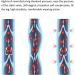 RVSKY Compression Socks for Edema & Varicose Veins - Thrombus Prevention - Elasticity Support Sleeves for Home Use - Buy Online on GoSupps.com