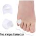 Silicone Toe Separator for Hallux Valgus - 2 Pack Foot Care Device for Bone Ectropion & Toe Alignment - Buy Online on GoSupps.com
