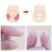 Ingrown Toenail Corrector Strips - 10pcs Bottle, Straightener Clip for Thick Toenails - Foot Tool for Correction - Buy Online on GoSupps.com