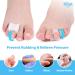 Hilph Gel Toe Separators - Hammer Toe Straightener & Bunion Relief (6 Pairs) for Overlapping & Crooked Toes - Best Toe Spacers - Buy Online on GoSupps.com