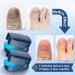 Nail Fungus Laser Treatment Device - 2 Pack for Onychomycosis | Effective Therapy for Discolored, Brittle Nails | Home Use for Fingernails & Toenails - Blue - Buy Online on GoSupps.com