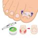 Sonew Stainless Steel Ingrown Toenail Correction Tool | Pain Relief & Paronychia Treatment Clip - Ship Internationally - Buy Online on GoSupps.com