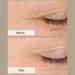 Unity Skincare Age Reversal Eye Serum with Retinol+ - Reduce Wrinkles and Dark Circles - 0.5 Fl Oz - Buy Online on GoSupps.com