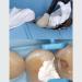 WindPlusya Dental Tofflemire Matrix Bands - 0.1mm White Profiled Tape for Dentistry | Narrow Plug-In Matrices - Buy Online on GoSupps.com