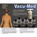 Vacu-Med Cupping Set | Anti-Pain Treatment | International Shipping Available - Buy Online on GoSupps.com