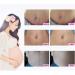 Best Stretch Mark Cream for Pregnancy & Postpartum - Repair & Remove Scars - Buy Online on GoSupps.com