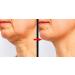 WHITESILK (15%) MATRIXYL + (2%) Argireline (BOTOX-Like) EXTREME Line Lifting Serum with Carnosine Penta-Exosome Vitamin B3 HA (30ml 1oz) - Buy Online on GoSupps.com