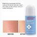 Ingrown Hair Treatment Smoothing Solution for Razor Bumps Hair Removal Aftercare | Hydrating Care for Underarms Legs Arms & Bikini Line - Buy Online on GoSupps.com