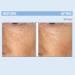 Serious Skincare Retinol Face & Neck Kit - 3-Piece Anti-Aging Set for Fine Lines & Wrinkles - A Force XR Serum A Cream XR Moisturizer Gel-to-Foam Cleanser - Buy Online on GoSupps.com