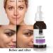 ican London Retinol 0.2% Serum Reducing Wrinkles Lines & Ageing on Face & Eyes 30ml - Buy Online on GoSupps.com