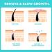 Magic Moisturizing Hair Removal Cream - Painless Upper Lip & Facial Mustache Treatment | Worldwide Shipping - Buy Online on GoSupps.com
