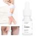 Wosune Permanent Hair Removal Serum - Hair Growth Inhibitor for Smooth & Reliable Legs and Arms - Buy Online on GoSupps.com