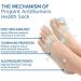 Sofeet Bunion Socks - New 2023 Projoint Antibunions Health Sock | Orthopedic Compression Bunions Relief | 4Pcs - Buy Online on GoSupps.com