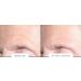 Age Reverse System - Rejuvenate Your Skin & Reverse Aging | Shop Internationally - Buy Online on GoSupps.com