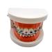 Dental Orthodontic Model with Metal Brackets and Arch Wire - Standard Teeth Model with Braces for Demonstration - Buy Online on GoSupps.com