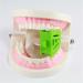 Dental Silicone Mouth Prop Set - 6 Pcs Latex Bites Block Openers in S, M, L Sizes - Buy Online on GoSupps.com