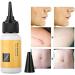 Delicate Skin Scar Treatment Serum - Acne Scar Removal & Repair Cream - 20ml - Buy Online on GoSupps.com