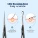 SSRoirvbb Portable Acne Needle Blackhead Clip Remover Extraction Popper Pore Black Head Cleaner Face Tools Needle Skin Cleansing Care Deep Black Cell circle - Buy Online on GoSupps.com