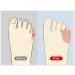 Norhogo Silicone Toe Separator - 4 Pairs for Pinky & Overlapping Toes Relief | Comfortable Toe Spreader for Pain & Pressure Relief - Buy Online on GoSupps.com