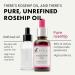 Rosehip Oil - Rose Oil for Face 100% Pure Rose Hip Oil for Skin Unrefined Rose Oil Hydrating Moisturizing and Softening Rosehip Oil for Face Natural Face Oil Rosehip Oil Organic - Buy Online on GoSupps.com
