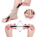 MengK Bunion Corrector: Toe Straightener & Alignment Strap for Bunion Relief - Buy Online on GoSupps.com