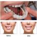 2 Pairs Regain Confidence Smile for Women and Men Temporarily Adjustable - Buy Online on GoSupps.com