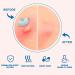 Buy Colorful Hydrocolloid Pimple Patches for Face | Star Acne Stickers in Small Medium Large | Salicylic Blemish Treatment - Buy Online on GoSupps.com