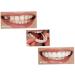 Buy Cucufa Instant Veneers - Cosmetic Teeth Covers for Perfect Smile | 2 Pairs of Upper & Lower Temporary Teeth - Buy Online on GoSupps.com