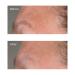 Perricone MD High Potency Classics Firming Serum 2 oz | Growth Factor Lifting Serum - Buy Online on GoSupps.com