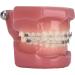 Dytah 1:1 Orthodontic Treatment Teeth Model - Patient Communication & Teaching Tool with Metal & Ceramic Brackets for Adults - Buy Online on GoSupps.com