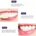 Body Accel Whitening Toothpaste with Niacinamide - Stain Remover for Dazzling White Teeth (1 pcs) | International Shipping Available - Buy Online on GoSupps.com
