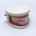 SUPVOX Dental Night Guard for Teeth Grinding - Orthodontic Protector for Kids & Adults - Buy Online on GoSupps.com