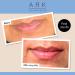 Buy Advanced Action Plumping Lip Cream 30ml - Best Lip Care for Fuller Lips | International Shipping Available - Buy Online on GoSupps.com