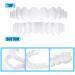 Fausses Dentaire Fausses Dents Les Placages S'enclenchent Dentier Amovible Haut Et en Bas pour Hommes Femmes Placages De Dents pour Dents Manquantes 2 Pairs - Buy Online on GoSupps.com