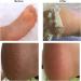 Pretty Skin Foot Peeling Mask - Exfoliates Repairs Moisturises for Dry Rough Feet - 16ml - 1 Pair - Buy Online on GoSupps.com