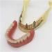 Zapion Dental Implant Model - Anatomical Lower Jaw Study Model for Overdentures & Teaching - Buy Online on GoSupps.com