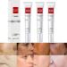 3PCS Crema Para Las Manchas De La Cara Crema para la cara Antiarrugas Face Moisturizer Cream Adecuado para varias reas como cara axilas cuello zona privade