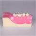 Fhuili Teeth Model for Training | Realistic Oral Tooth Demonstration & Recovery Model for Study | International Shipping - Buy Online on GoSupps.com