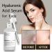 Hyaluronic Acid 2% + B5 Hyaluronic Acid for Face Hydrated Skincare Serum Hyaluronic Acid Serum for Face Hyaluronic Acid Serum Skin Repair Face Serum Face Serum for Women & Men Skin Care 30ml - Buy Online on GoSupps.com