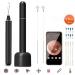 SMSOM Ear Wax Removal Tool Ear Wax Removal Endoscope Otoscope Earwax Remover Tools with 1080P FHD Camera 6 Led Lights Wireless Connected Smart Phones (Color : Red) - Buy Online on GoSupps.com