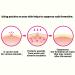 TOSOWOONG SOS Repair CICA Clinic Magic Patch (60 Count) | Hydrocolloid Pimple Patches - Buy Online on GoSupps.com