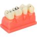 Ververt Touch Tooth Model - 180mm Dental Caries Demonstration Model for Schools & Dentists | Learning Aid for Dental Lessons - Buy Online on GoSupps.com