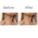 Anti-Aging Silicone Neck & Chest Wrinkle Patches - Skin Firming & Moisturizing Treatment | Reusable Overnight Smoother for Decolletage - 1 Pack - Buy Online on GoSupps.com