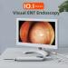 RKXKJ Ear Wax Removal Tool - Super Large 10.1 Inch IPS Screen Camera, 3.2mm Ear Scope, IPX6 Waterproof - Ear Care Solution - Buy Online on GoSupps.com