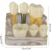 4x Dental Implant Teeth Model with Removable Crown - Crown & Bridge Dentist Training Tool for Patient Analysis | International Shipping - Buy Online on GoSupps.com