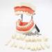 Vinbcorw Dental Care Model - 24 Removable Teeth for Adult Teaching (12x9.5 cm) - Ideal for Dentists & Educators - Buy Online on GoSupps.com