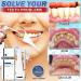 Calculusfree Dissolving Dental Spray - Mouth Refreshing Teeth Cleaner & Stain Remover - 1 G (1 Pack) for Ultimate Oral Care - Buy Online on GoSupps.com