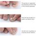 2-Piece Set Stainless Steel Ingrown Toenail Corrector Ingrown Toenail Correction Buckle Paronychia Correction Tool Repairing Nails That Grow Inward to Improve Their Shape and Reduce Pain - Buy Online on GoSupps.com