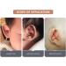 Baby Auricle Valgus Correction Patch - Protruding Ear Sticker for Toddlers | Baby Ear Aesthetic Corrector - Buy Online on GoSupps.com